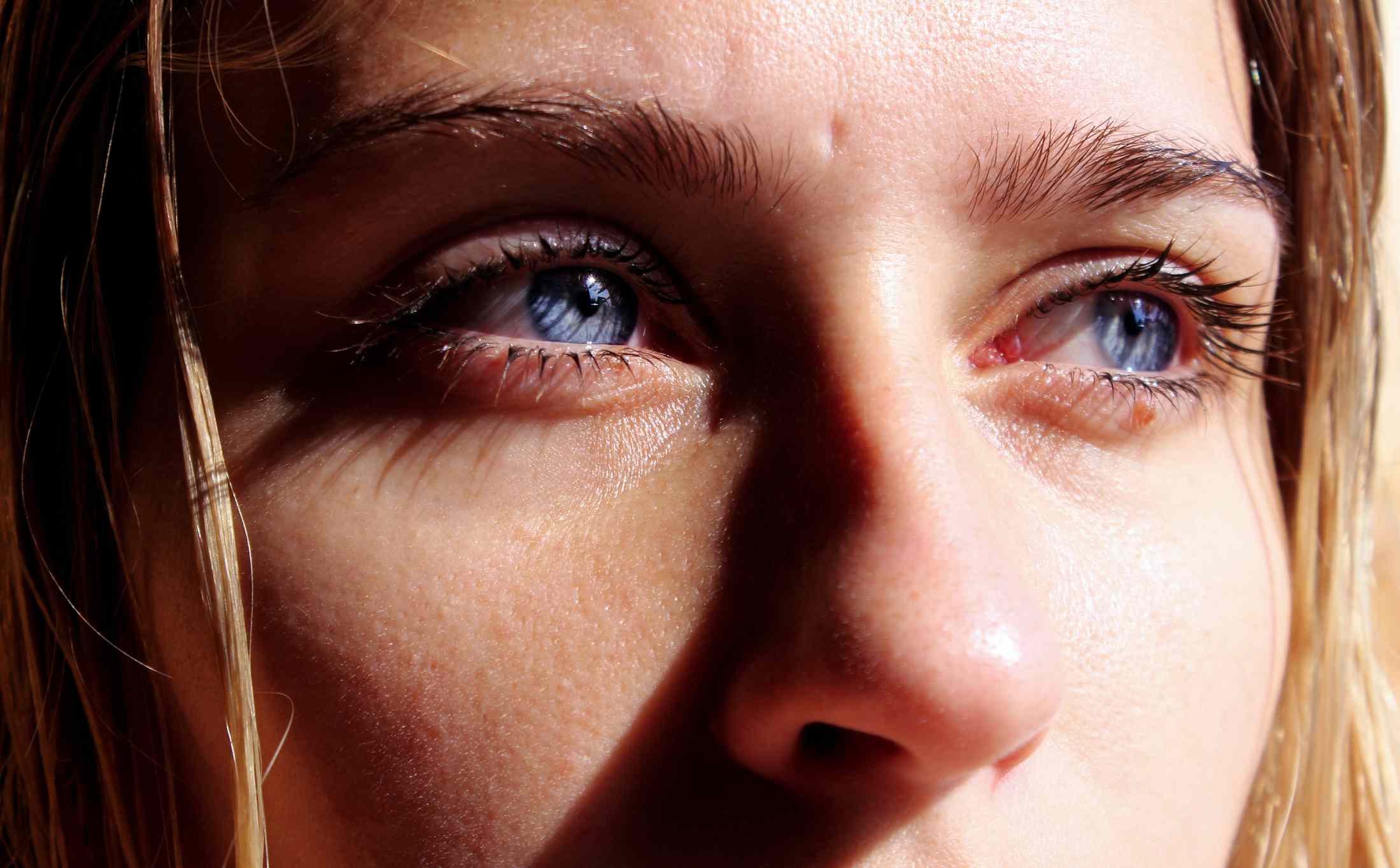 Are Blue Eyes More Sensitive To Light? What To Know