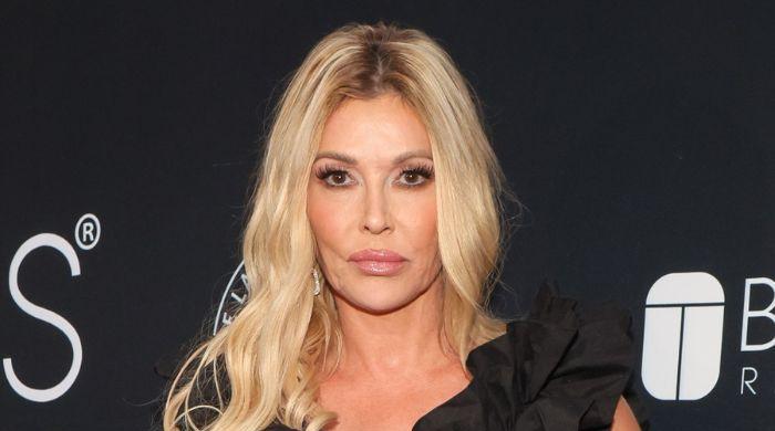 Brandi Glanville in agony as mysterious illness ravages her face and teeth