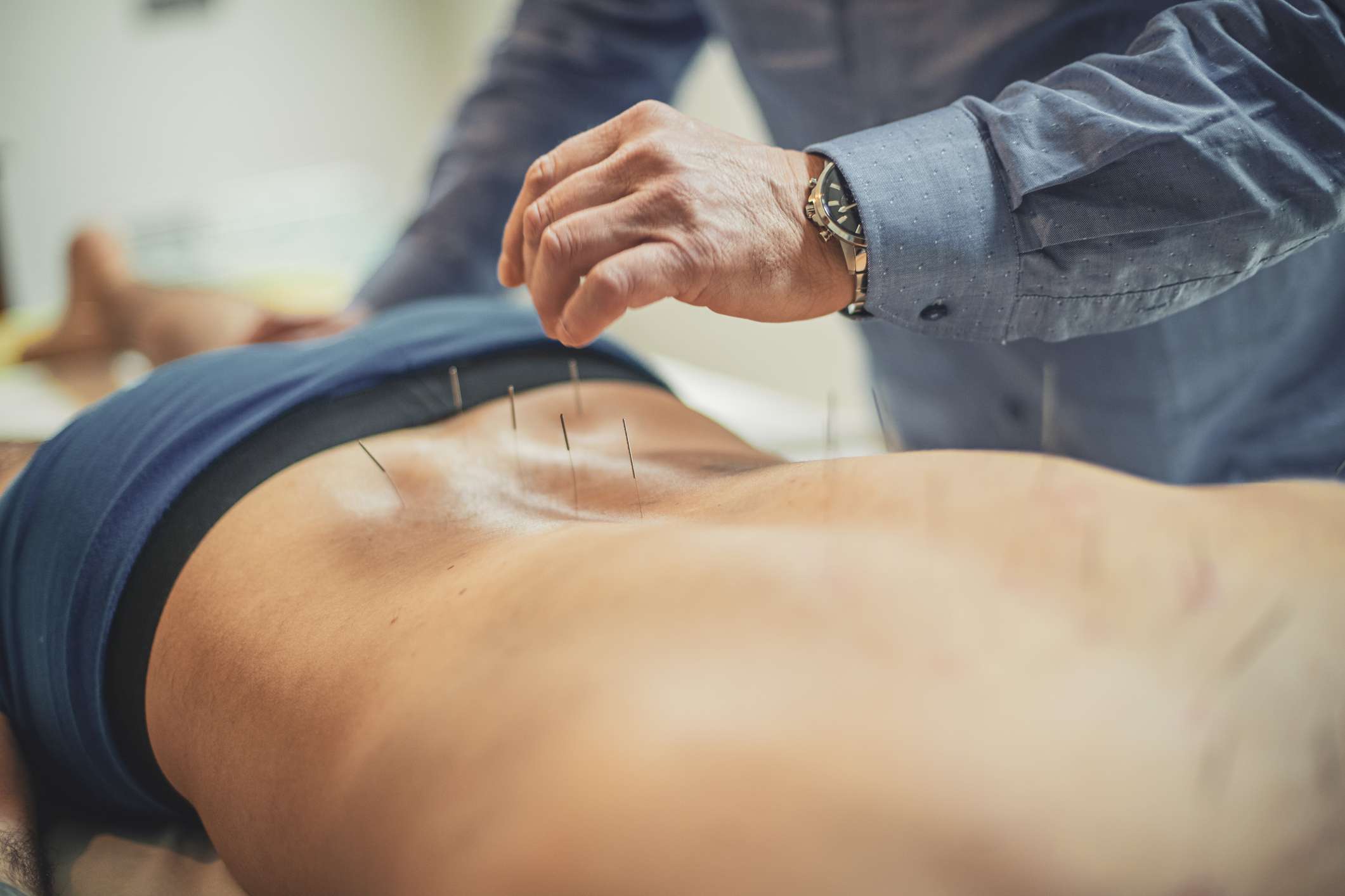 Can Acupuncture Ease Your Back Pain? Benefits and Risks To Know