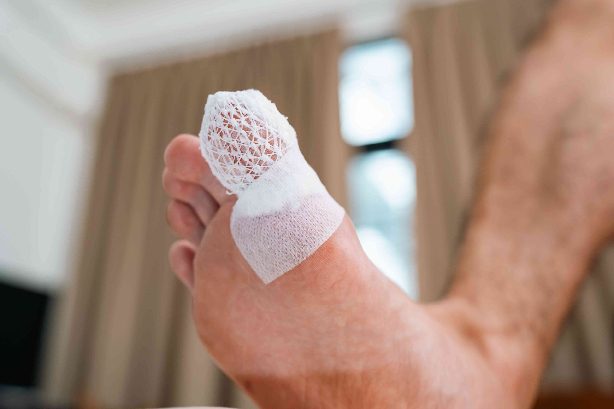 Dealing With an Ingrown Toenail? This Treatment Could Help