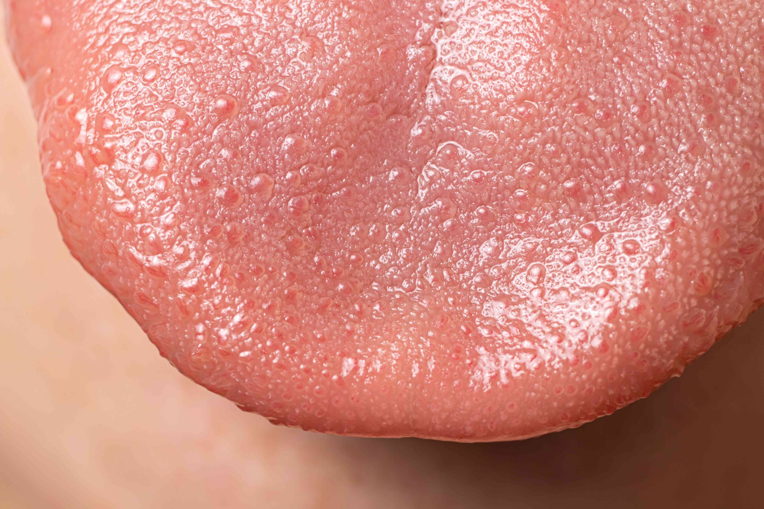 Not Sure About That Tongue Bump? Here's What To Look For