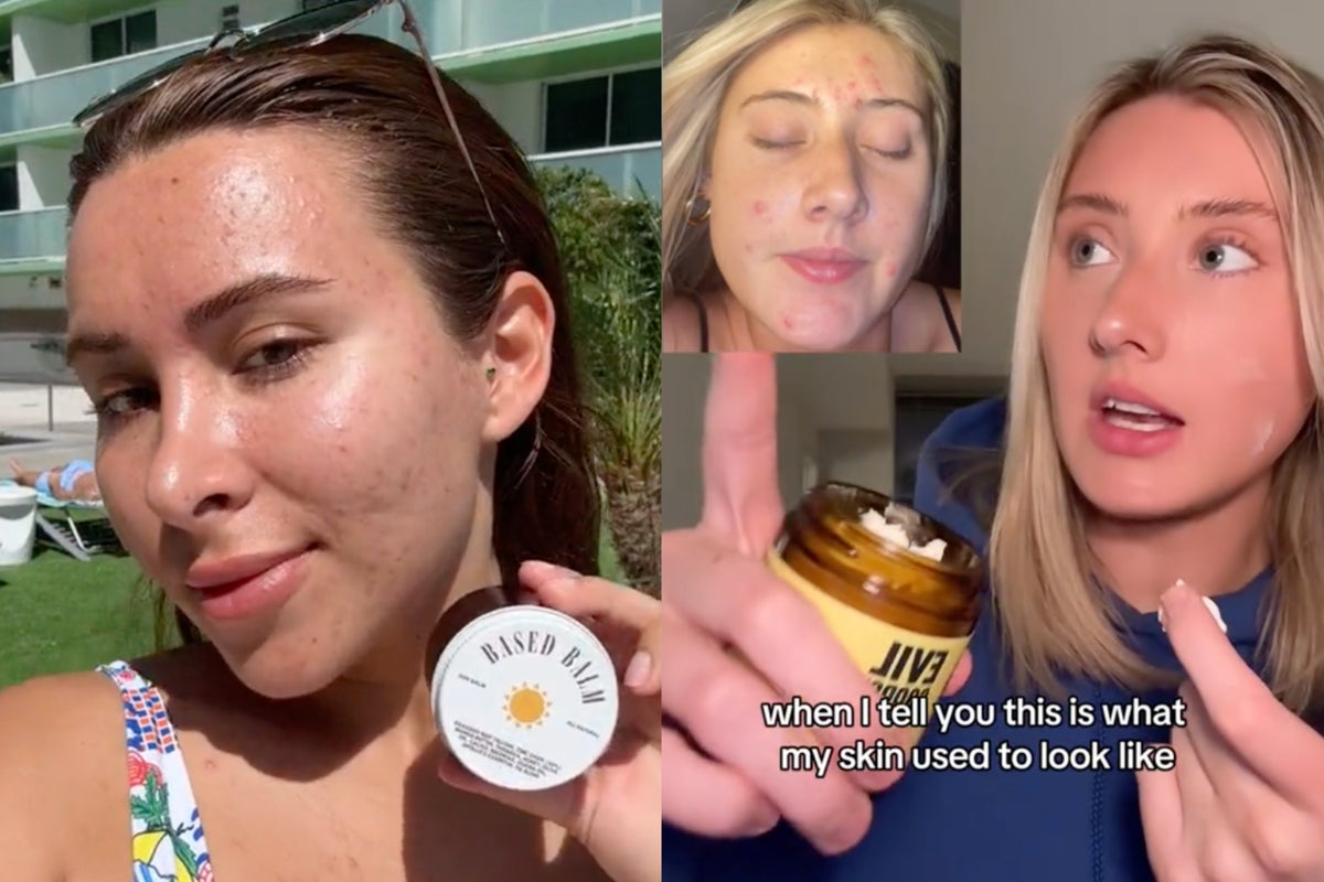 Scientists question TikTok’s new beef tallow hack for skin care