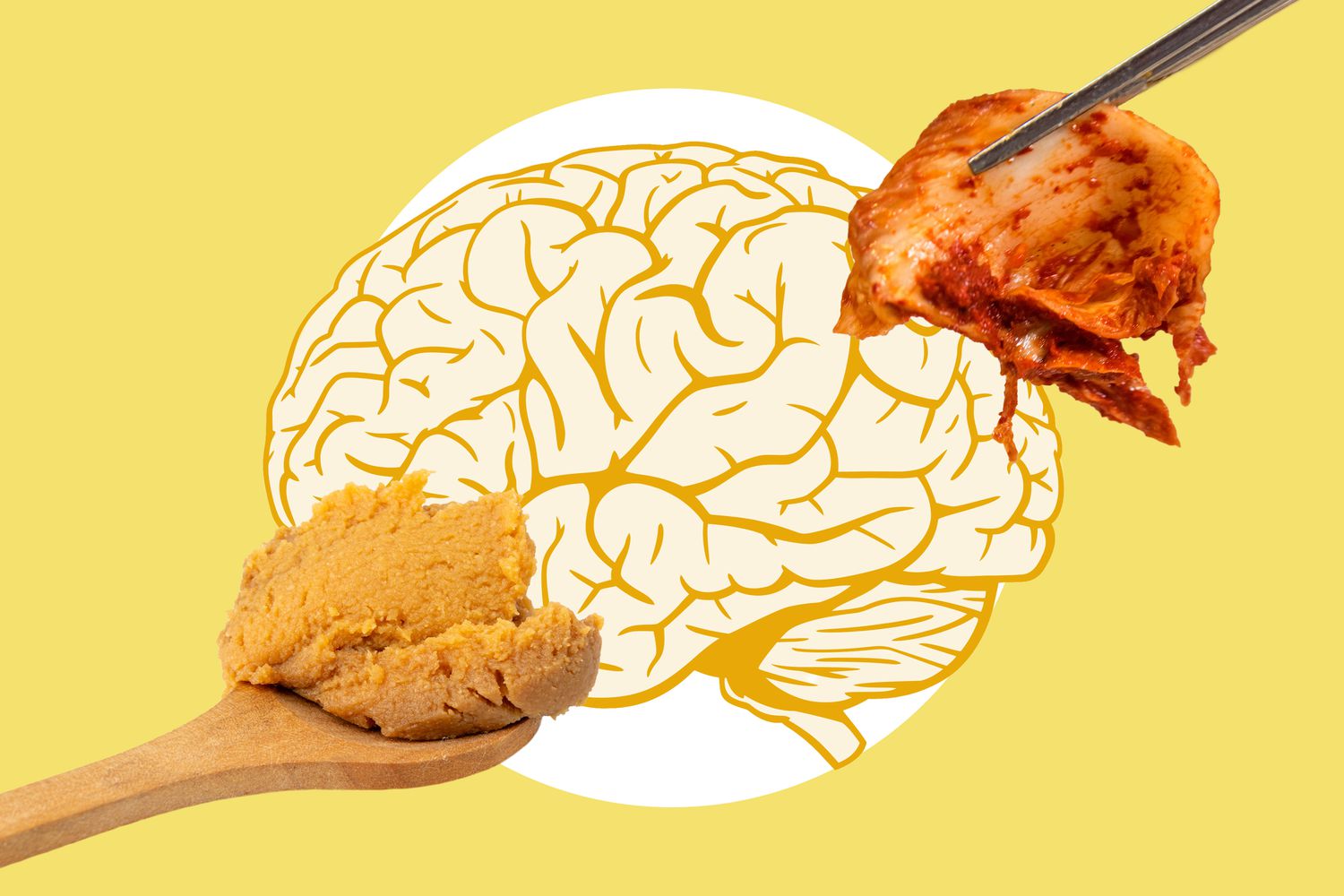 Struggling With Anxiety? New Research Says Foods Like Kimchi and Miso Can Help